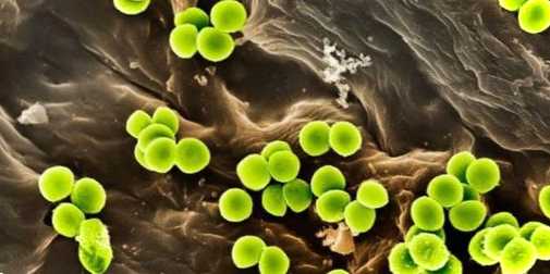 Які бактерії живуть у грунті фото, назви представників, що підвищують родючість