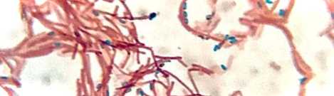 Як і де застосовується бактеріальна культура